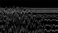 museo-marco-Mauricio Limon-Regiones electroencefalograficas